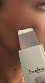ULTRASONIC SKIN PERFECTOR